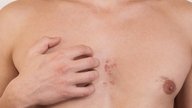 Comezón en los senos: 7 causas y cómo calmarla