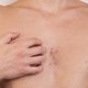 7 Causas de comezón en los senos y qué hacer