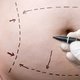 Abdominoplastia: qué es, cómo se realiza y vea el antes y después