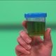 Green Urine: 4 Common Causes & What to Do