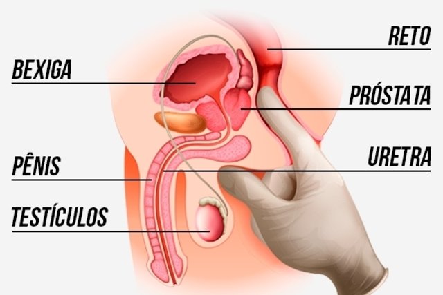 examen de prostata nombre cientifico