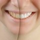 Cómo blanquear los dientes: 3 remedios caseros