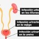 Síntomas de infección urinaria 