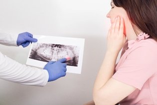 Dente siso: sintomas, quando tirar e como é a recuperação