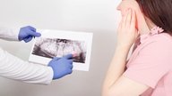 Dente siso: sintomas, quando tirar e como é a recuperação