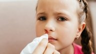 Sangramento nasal infantil: 6 principais causas (e o que fazer)