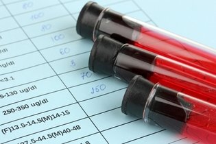 Imagem ilustrativa do artigo pH do sangue: valor normal, como medir e sintomas
