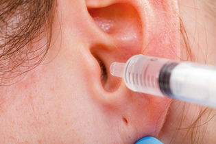 Imagen ilustrativa del artículo Lavado de oídos: para qué sirve y posibles riesgos 