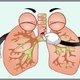 Bronquitis: síntomas, causas y tratamiento