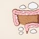Candidíase intestinal: o que é, sintomas, causas e tratamento