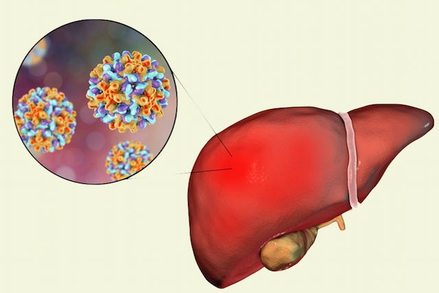 Tudo sobre Hepatite B