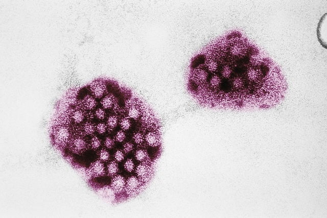 Norovirus Qué Es Síntomas Y Tratamiento Tua Saúde 1953