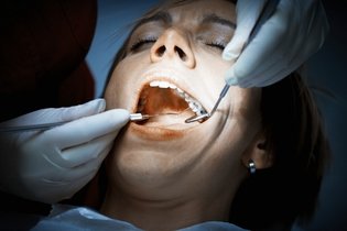 O que é a obturação do dente, quando é indicada e como é feita