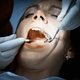 O que é a obturação do dente, quando é indicada e como é feita
