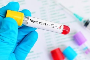 Illustrative image of the article Nipah Virus: Symptoms, Transmission, Treatment & Prevention