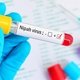 Vírus Nipah: o que é, sintomas, prevenção e tratamento