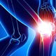 Líquido en la rodilla: tiempo de recuperación y tratamiento