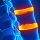 Dolor en la espalda alta y media: posibles causas y qué hacer