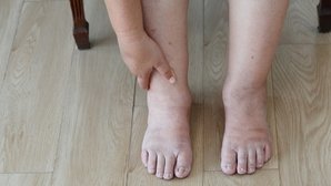 Manos y pies hinchados: 14 causas y qué hacer