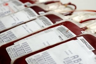 Transfusão de sangue: o que é, quando é necessária e como é feita