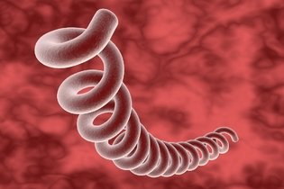 Imagen ilustrativa del artículo Chancro sifilis: qué es, síntomas y tratamiento
