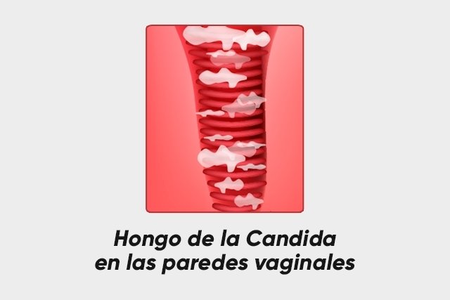 Candidiasis 😱. Acaba con los hongos vaginales