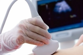 Cirugía para quitar un nódulo de la mama: cómo se realiza y riesgos