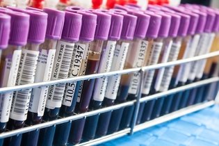 Illustrative image of the article Blood Tests For Cancer: 13 Tests Used For Diagnosis