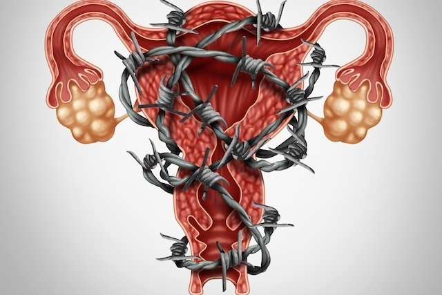 Douleurs aux ovaires : 8 causes principales (et que faire) - Tua Saúde