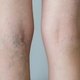 Itchy Legs: 6 Common Causes & What to Do