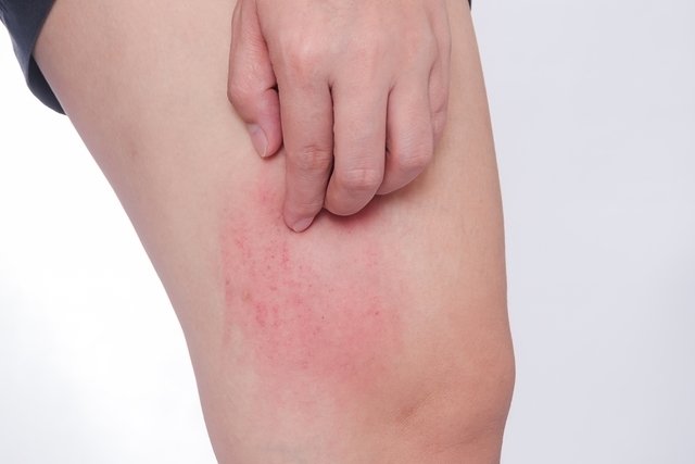 alergii inflamatii articulare injectat în articulația genunchiului pentru durere
