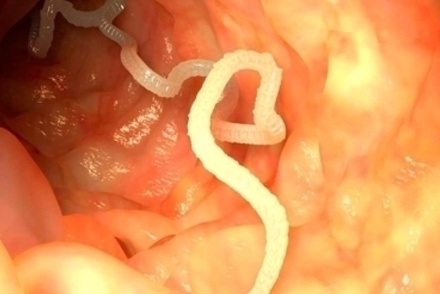 gusanos intestinales en adultos