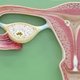 Ovario poliquístico: qué es, síntomas y tratamiento