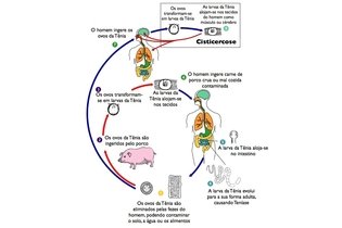 Imagem ilustrativa do artigo Cisticercose: o que é, sintomas, ciclo de vida e tratamento