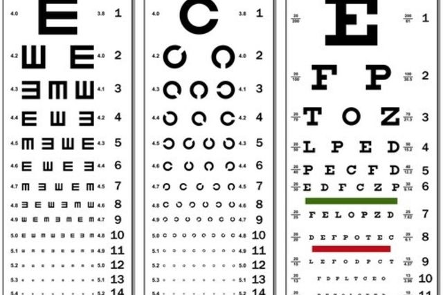 Exame oftalmológico: quando fazer e para que serve - Tua Saúde