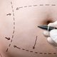 Abdominoplastia: o que é, como é feita e possíveis complicações