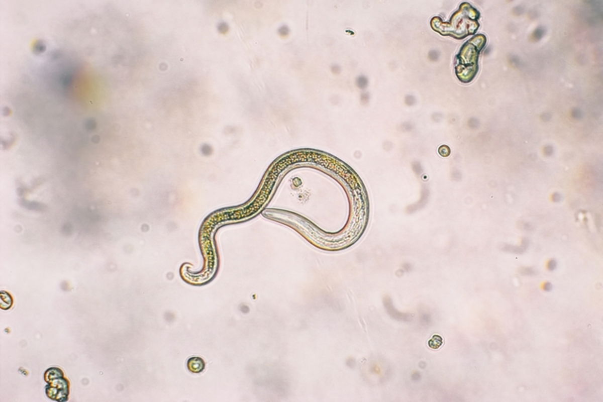 Larva de Toxocara canis