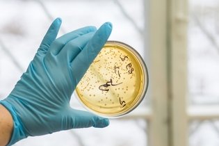 Imagem ilustrativa do artigo Acinetobacter: o que é, sintomas, como acontece a infecção e tratamento
