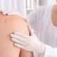 Herpes zóster: o que é, sintomas, causas e tratamento