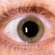 5 exames essenciais para identificar o glaucoma