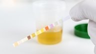 What Causes Ketones in Urine (& What To Do)