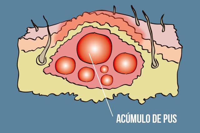 Imagem ilustrativa número 3