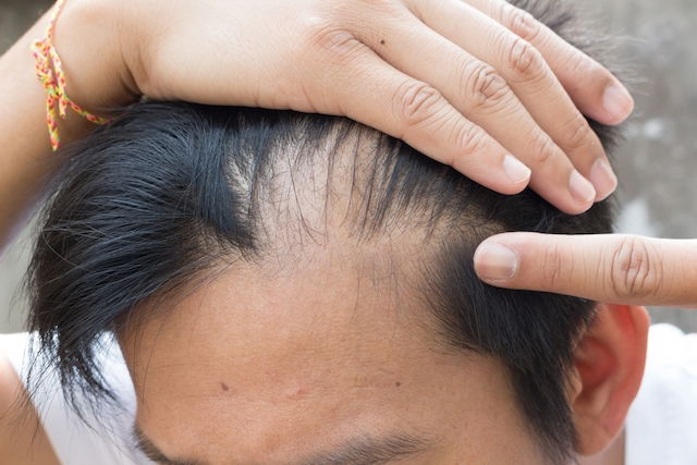 O cabelo parou de crescer? Veja 4 fatores que podem estar causando