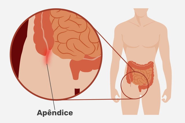 When Should You Worry About Pain in the Lower Abdomen