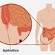 Dor de apendicite: como é, quantos dias dura e o que fazer