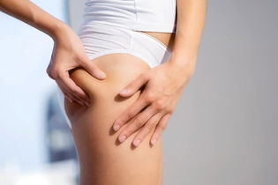 Illustrative image of the article How to Get Rid of Cellulite (& Is It Possible to Eliminate?)