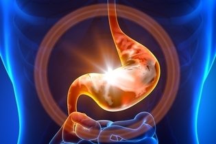 Metaplasia intestinal: o que é, sintomas e tratamento