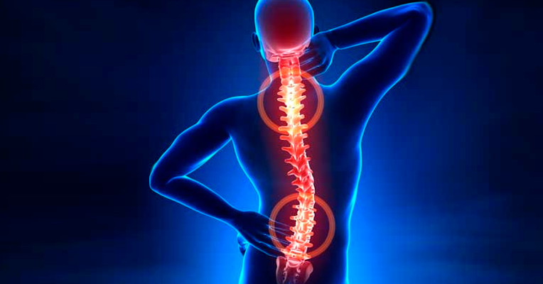 Dores nas costas podem ser sintomas de hérnia de disco