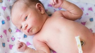 Coto umbilical: o que é e como cuidar do umbigo do recém-nascido